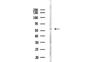 Western blot analysis of lysates from 293 cells(LPS 4h treatment), using TBXAS1 Antibody at 1/1000 dilution.