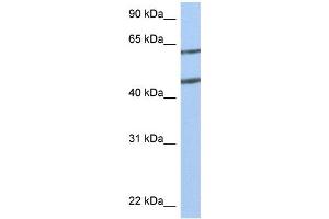 WB Suggested Anti-NTN4 Antibody Titration:  0.