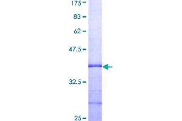 COL6A1 Protein (AA 919-1028) (GST tag)