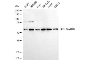 Western blotting analysis using CAMK2B antibody (ABIN7797833).