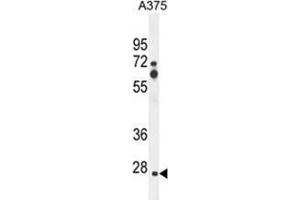 ZCCHC17 Antibody (Center) western blot analysis in A375 cell line lysates (35 µg/lane). (ZCCHC17 antibody  (Middle Region))