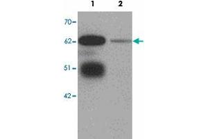 Western blot analysis of LRRTM3 in mouse brain tissue lysate with LRRTM3 polyclonal antibody  at 0. (LRRTM3 antibody  (C-Term))
