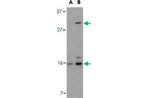 Western blot analysis of DRAM in 293 cell lysate with DRAM polyclonal antibody  at (A) 0.