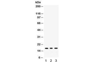 Western blot testing of 1) rat liver, 2) mouse liver, 3) human HepG2 lysate with MGST1 antibody. (MGST1 antibody)