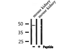 Western blot analysis of extracts from mouse kidney, using IP6K2 Antibody. (IP6K2 antibody  (Internal Region))