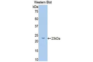 Western blot analysis of the recombinant protein. (GCKR antibody  (AA 90-286))