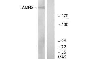 Western blot analysis of extracts from RAW264. (LAMB2 antibody)
