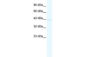 WB Suggested Anti-BTBD14B Antibody Titration:  2. (NAC1 antibody  (Middle Region))