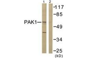 Western blot analysis of extracts from 293 cells, treated with Etoposide 25uM 60', using PAK1 (Ab-212) Antibody.