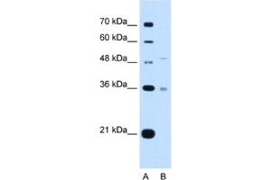 Western Blotting (WB) image for anti-Uronyl-2-Sulfotransferase (UST) antibody (ABIN2462994) (UST antibody)
