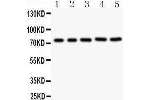 Observed bind size: 76KD (RIPK1 antibody  (AA 316-671))
