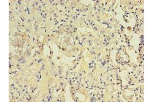 Immunohistochemistry of paraffin-embedded human lung tissue using ABIN7144554 at dilution of 1:100 (ACAP1 antibody  (AA 1-266))