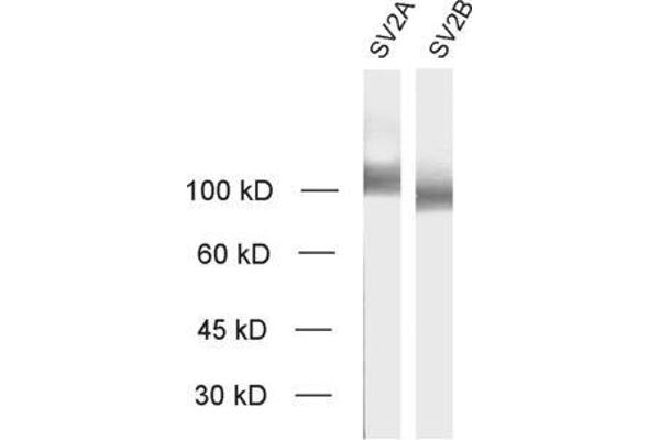 SV2A antibody  (AA 2-17)