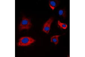 Immunofluorescent analysis of Synapsin 1 (pS9) staining in A549 cells. (SYN1 antibody  (N-Term, pSer9))