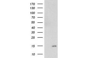 HEK293T cells were transfected with the pCMV6-ENTRY control (Left lane) or pCMV6-ENTRY NDUFA7 (Right lane) cDNA for 48 hrs and lysed. (NDUFA7 antibody)