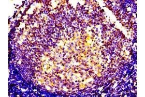 Immunohistochemistry of paraffin-embedded human lymph node tissue using ABIN7146111 at dilution of 1:100 (CXCR5 antibody  (AA 1-55))