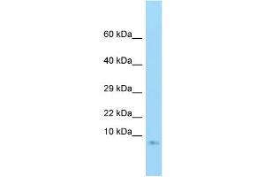 WB Suggested Anti-GNG3 Antibody Titration: 1. (GNG3 antibody  (Middle Region))