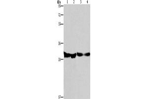 Western Blotting (WB) image for anti-2,4-Dienoyl CoA Reductase 1, Mitochondrial (DECR1) antibody (ABIN2432931) (DECR1 antibody)