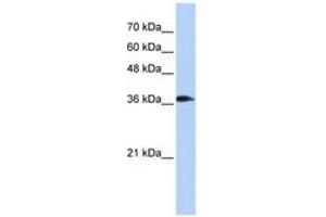 Image no. 1 for anti-ATPase, H+ Transporting, Lysosomal 38kDa, V0 Subunit D2 (ATP6V0D2) (C-Term) antibody (ABIN6741341) (ATP6V0D2 antibody  (C-Term))