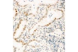 Immunohistochemical analysis of ZNF596 staining in human kidney formalin fixed paraffin embedded tissue section. (ZNF596 antibody)