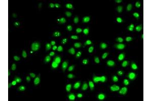 Immunofluorescence analysis of HeLa cells using TP53 antibody (ABIN5999084). (p53 antibody)