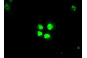 Anti-SATB1 mouse monoclonal antibody (ABIN2452628) immunofluorescent staining of COS7 cells transiently transfected by pCMV6-ENTRY SATB1 (RC200421). (SATB1 antibody)