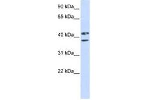 Image no. 1 for anti-Zinc Finger Protein 265 (Zranb2) (AA 144-193) antibody (ABIN6743051) (ZNF265 antibody  (AA 144-193))
