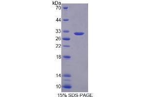 SDS-PAGE analysis of Human PLA2G3 Protein. (PLA2G3 Protein)