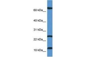 Image no. 1 for anti-TCR gamma Alternate Reading Frame Protein (TARP) (AA 7-56) antibody (ABIN6746905) (TARP antibody  (AA 7-56))