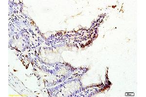 Formalin-fixed and paraffin embedded rat colon tissue labeled with Anti-CDX2/3 Polyclonal Antibody, Unconjugated (ABIN1387257) at 1:200 followed by conjugation to the secondary antibody (CDX2+3 (AA 151-260) antibody)