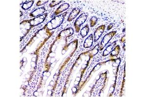 IHC analysis of HAUSP/USP7 using anti-HAUSP/USP7 antibody (ABIN6719603). (USP7 antibody  (AA 258-483))