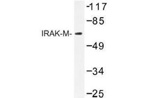 Image no. 1 for anti-Interleukin-1 Receptor-Associated Kinase 3 (IRAK3) antibody (ABIN317722) (IRAK3 antibody)