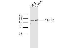 Mouse lung and lymph node lysates probed with Rabbit Anti-CRLR/CGRPR1 Polyclonal Antibody, Unconjugated  at 1:500 for 90 min at 37˚C. (Crlr/Cgrpr1 (AA 281-380) antibody)