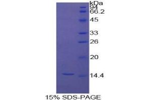 SDS-PAGE (SDS) image for Inhibin, beta A (INHBA) (AA 310-425) protein (His tag) (ABIN1079915) (INHBA Protein (AA 310-425) (His tag))