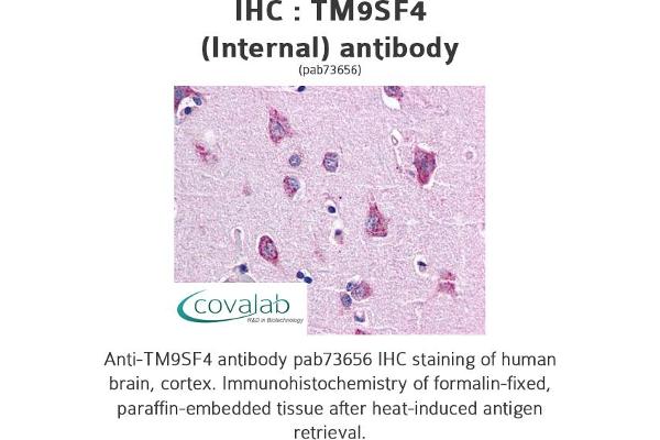 TM9SF4 antibody  (Internal Region)
