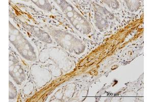 Immunoperoxidase of monoclonal antibody to CNN1 on formalin-fixed paraffin-embedded human small Intestine. (CNN1 antibody  (AA 1-297))