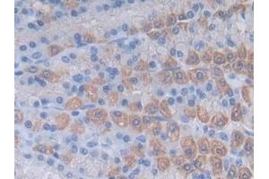Immunohistochemistry (IHC) image for anti-Syndecan 1 (SDC1) (AA 58-313) antibody (ABIN7434422)