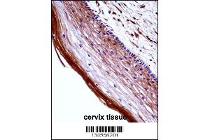 PGF Antibody immunohistochemistry analysis in formalin fixed and paraffin embedded human cervix tissue followed by peroxidase conjugation of the secondary antibody and DAB staining. (PLGF antibody  (AA 120-148))