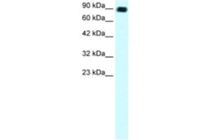 Western Blotting (WB) image for anti-Zinc Finger Protein 828 (ZNF828) antibody (ABIN2460309) (ZNF828 antibody)