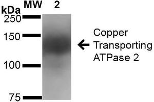 Western Blot analysis of Rat Brain Membrane showing detection of ~160 kDa Copper Transporting ATPase 2 protein using Mouse Anti-Copper Transporting ATPase 2 Monoclonal Antibody, Clone S62-29 . (ATP7B antibody  (AA 3-21) (Biotin))