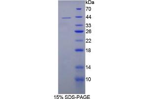 Image no. 1 for Interleukin 12 beta (IL12B) (AA 30-311) protein (His tag) (ABIN6236552) (IL12B Protein (AA 30-311) (His tag))