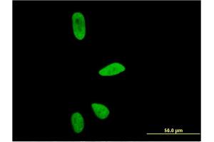 Immunofluorescence of monoclonal antibody to CD3EAP on HeLa cell. (CD3EAP antibody  (AA 2-110))