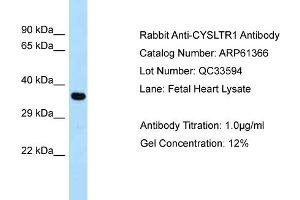 Western Blotting (WB) image for anti-Cysteinyl Leukotriene Receptor 1 (CYSLTR1) (C-Term) antibody (ABIN2788780) (CysLTR1 antibody  (C-Term))