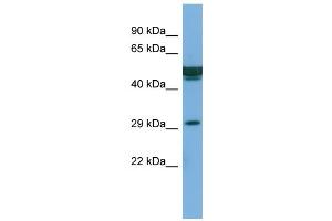 Host:  Rabbit  Target Name:  FAM3B  Sample Type:  PANC1 Whole cell lysates  Antibody Dilution:  1. (FAM3B antibody  (Middle Region))