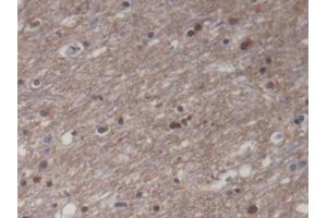 DAB staining on IHC-P; Samples: Human Cerebrum Tissue (CKM antibody)