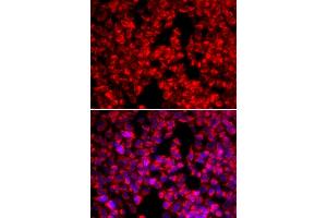 Immunofluorescence analysis of U2OS cells using MTTP antibody. (MTTP antibody)