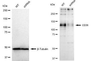 Western blotting analysis using CD36 antibody (ABIN7797966).