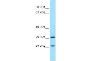 WB Suggested Anti-SLC25A10 Antibody Titration: 1. (SLC25A10 antibody  (Middle Region))