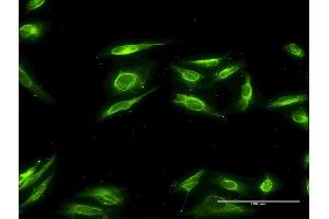 Immunofluorescence of monoclonal antibody to AKR1B10 on HeLa cell.