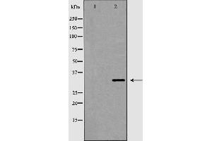 Western blot analysis of VDAC2 expression in HeLa.